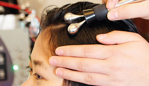 改善脫發(fā)及頭皮問(wèn)題問(wèn)題